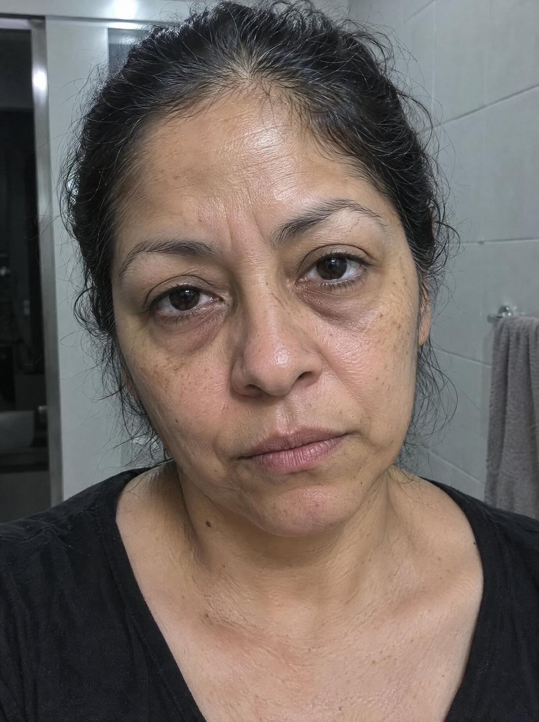 Las ojeras se ven hundidas