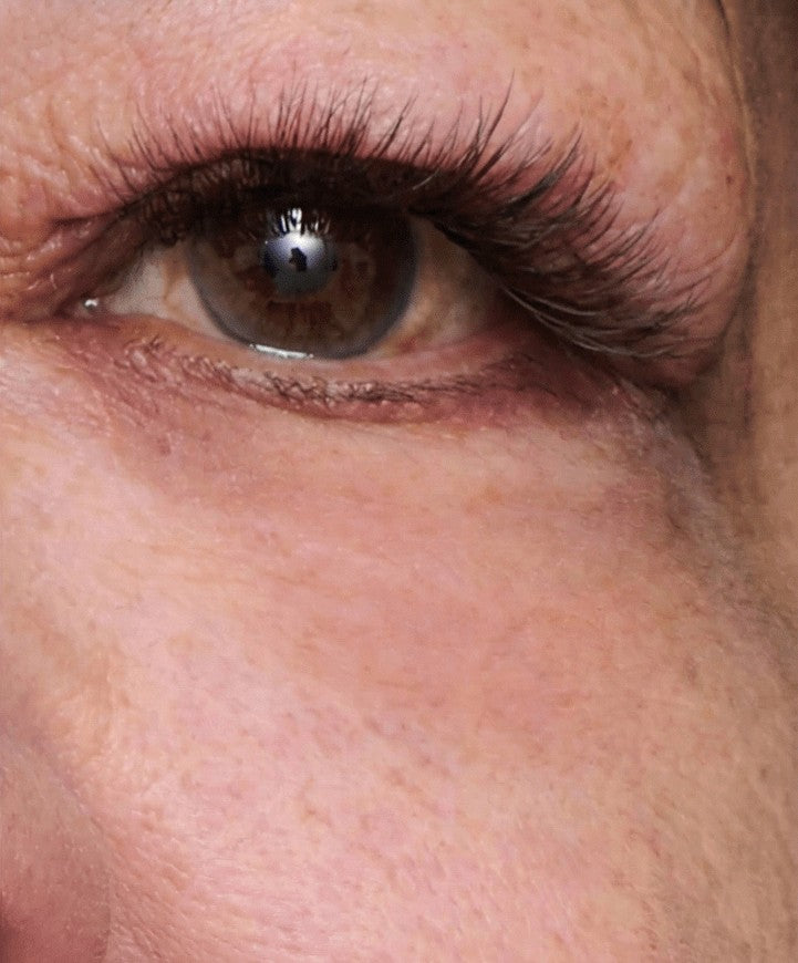 Contorno de ojos antes y 60 segundos después de aplicar el tensor EyeLift