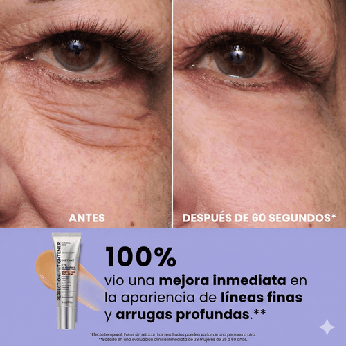 Alorah EyeLift™ - Tensor Instantáneo de Ojos para una mirada más lisa y descansada