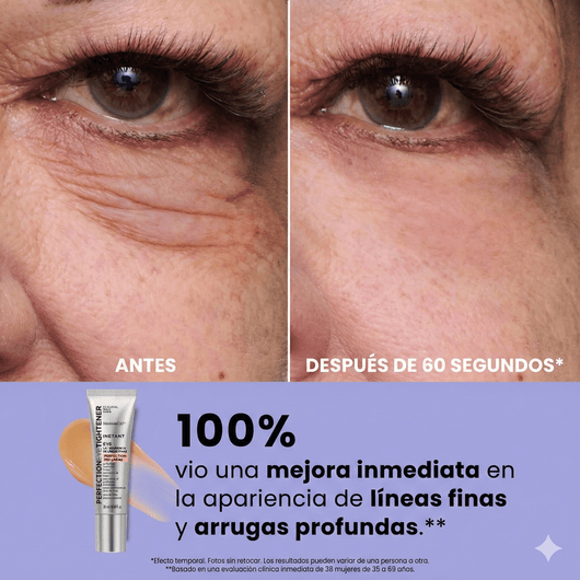 InfiniteLift - Gel tensor rejuvenecedor de ojos - Alorah Beauty