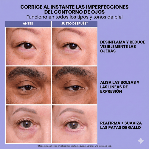 Alorah EyeLift™ - Tensor Instantáneo de Ojos para una mirada más lisa y descansada