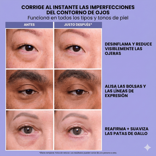 InfiniteLift - Gel tensor rejuvenecedor de ojos - Alorah Beauty