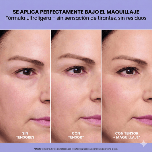 InfiniteLift - Gel tensor rejuvenecedor de ojos - Alorah Beauty